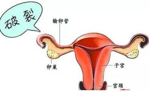 孕41周不打催产针的危害一览，会危及胎儿生命并非谣言